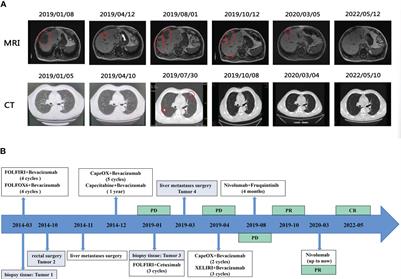 Case Report: Genetic and immune microenvironmental characteristics of a rectal cancer patient with MSS/PD-L1-negative recurrent hepatopulmonary metastasis who achieved complete remission after treatment with PD-1 inhibitor